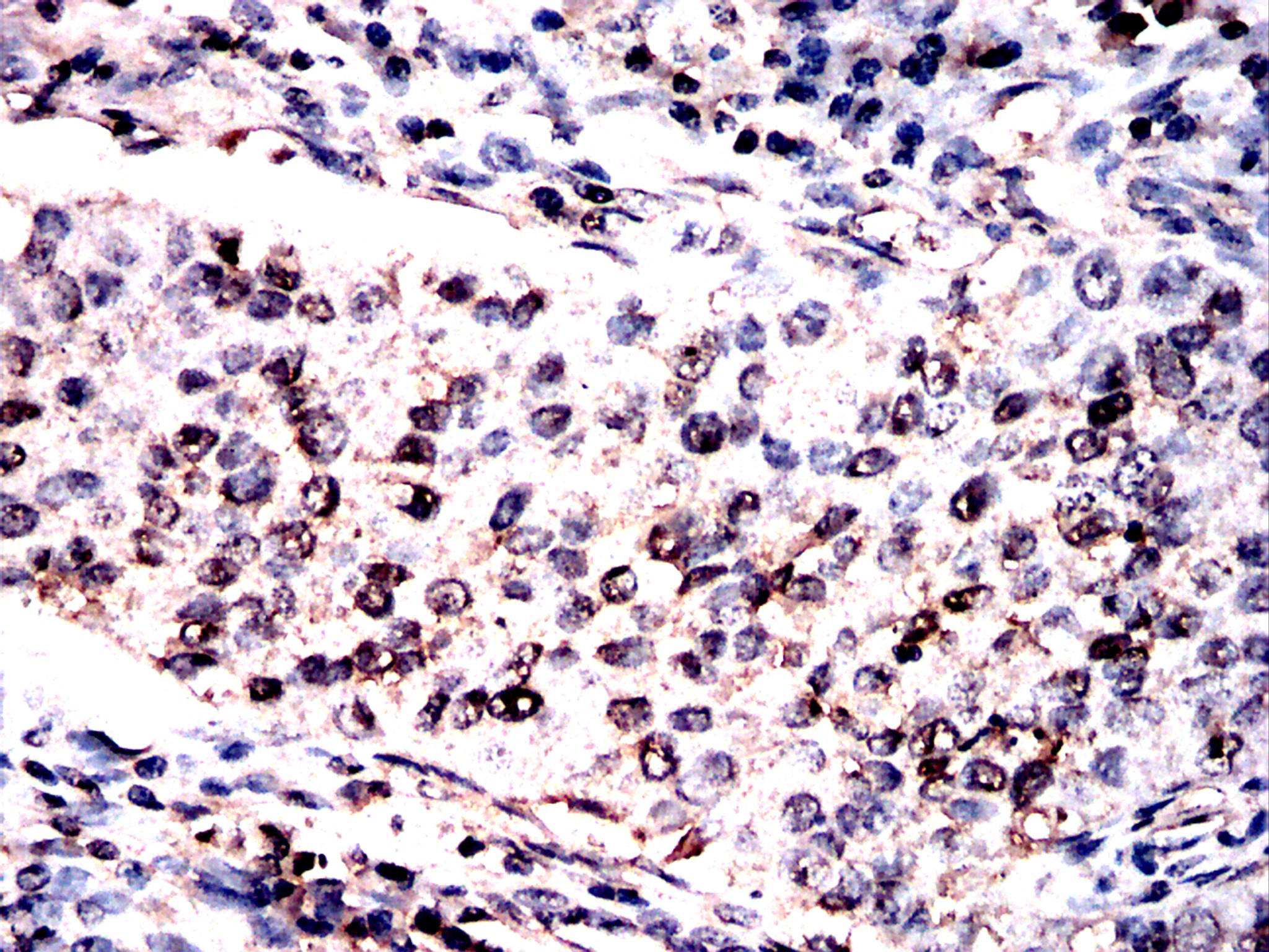                          IHC